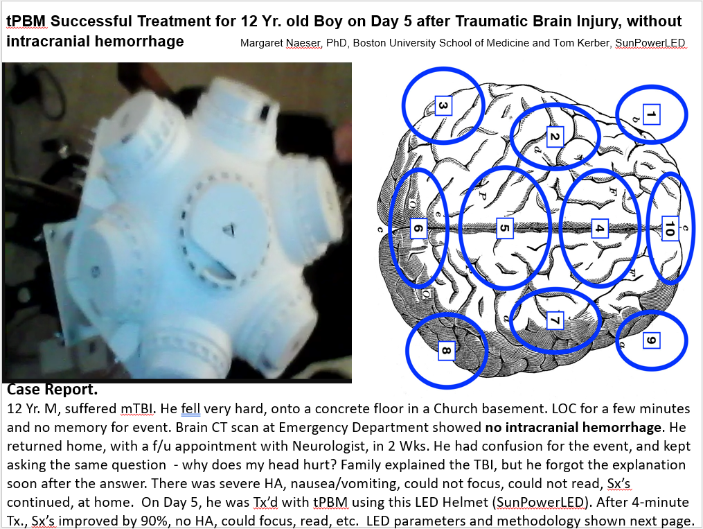 tPBM Successful Treatment for 12 Yr. old Boy - p1