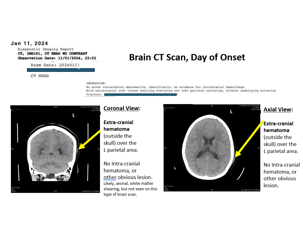 Dr. Naeser - PBM2024 - PowerPoint Slides - 2