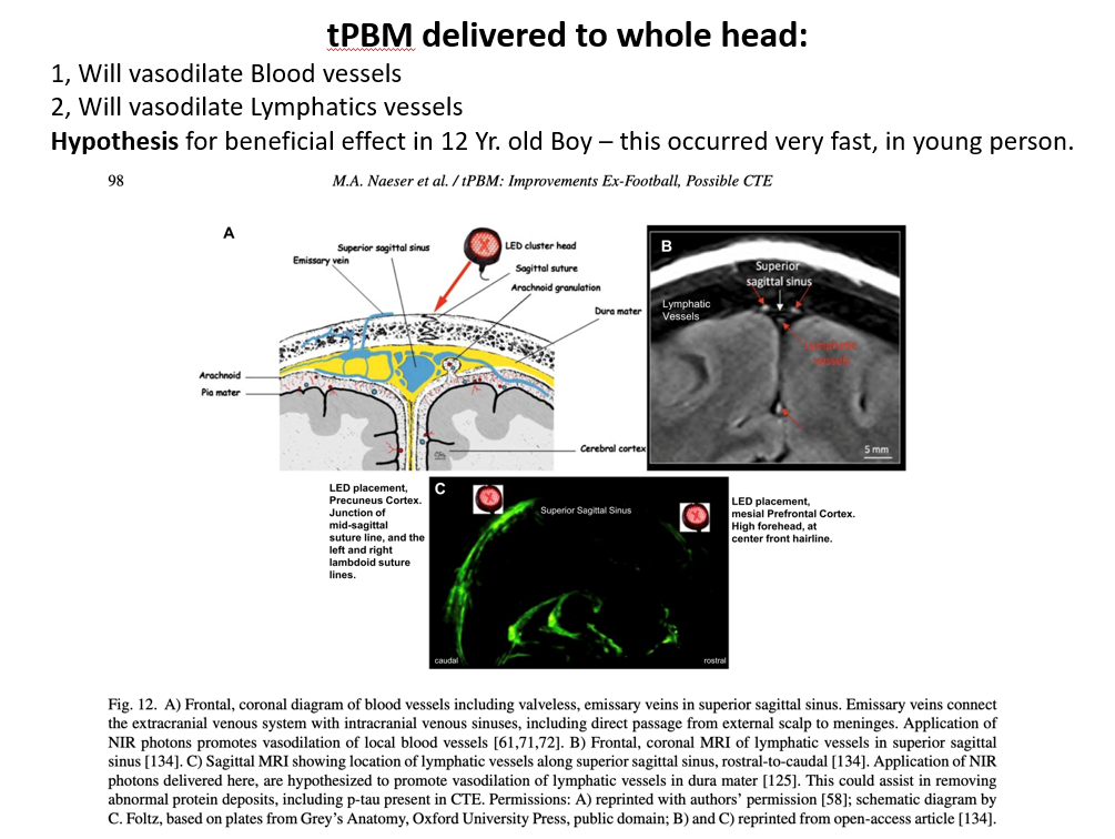 Dr. Naeser - PBM2024 - PowerPoint Slides - 5 of 5